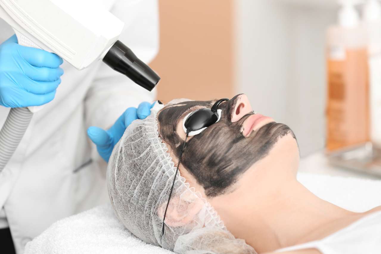 Carbon Facial Treatment in Greater Noida - Esthetica Aesthetic Clinic 1