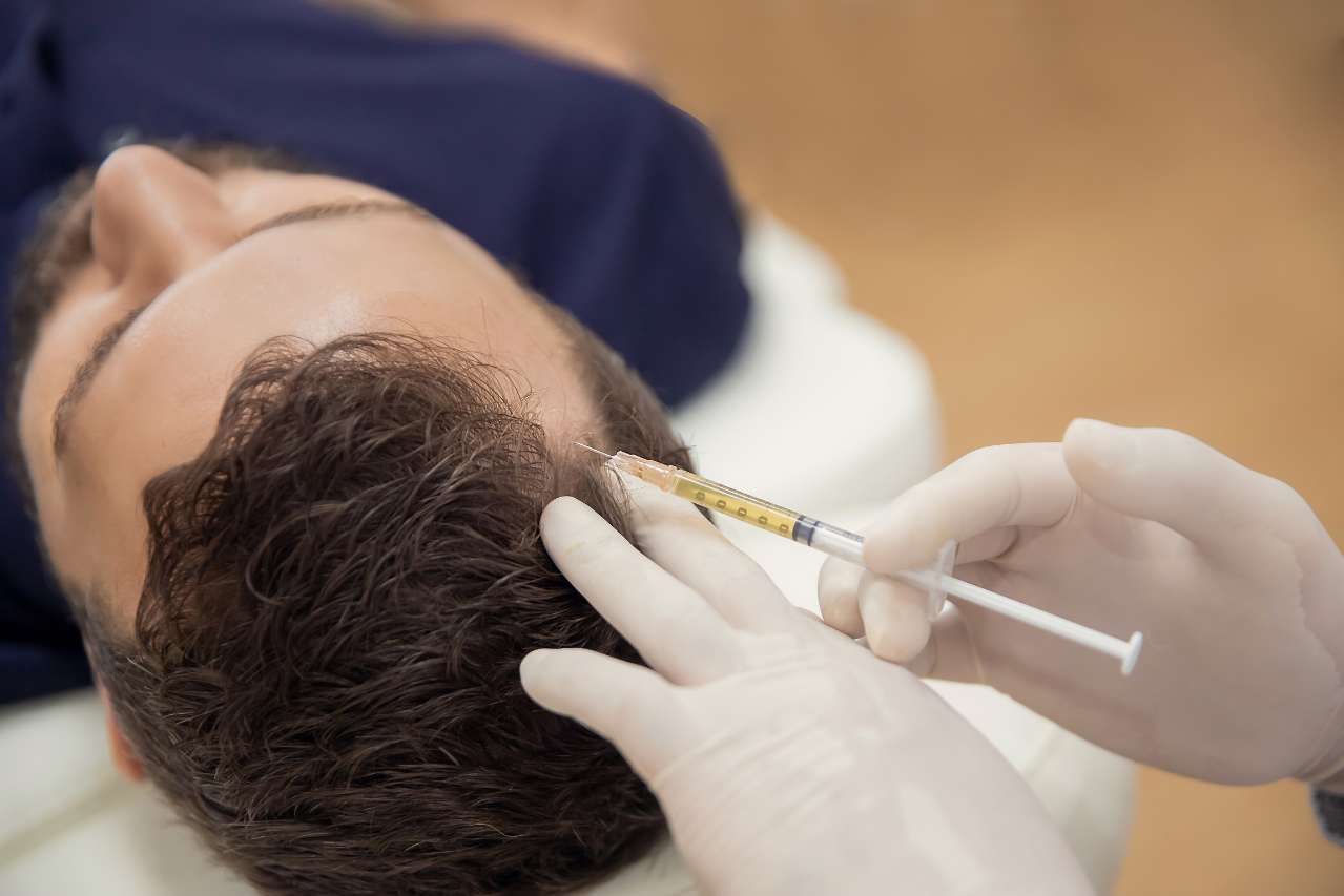 Hair PRP Treatment in Greater Noida - Esthetica Aesthetic Clinic 1