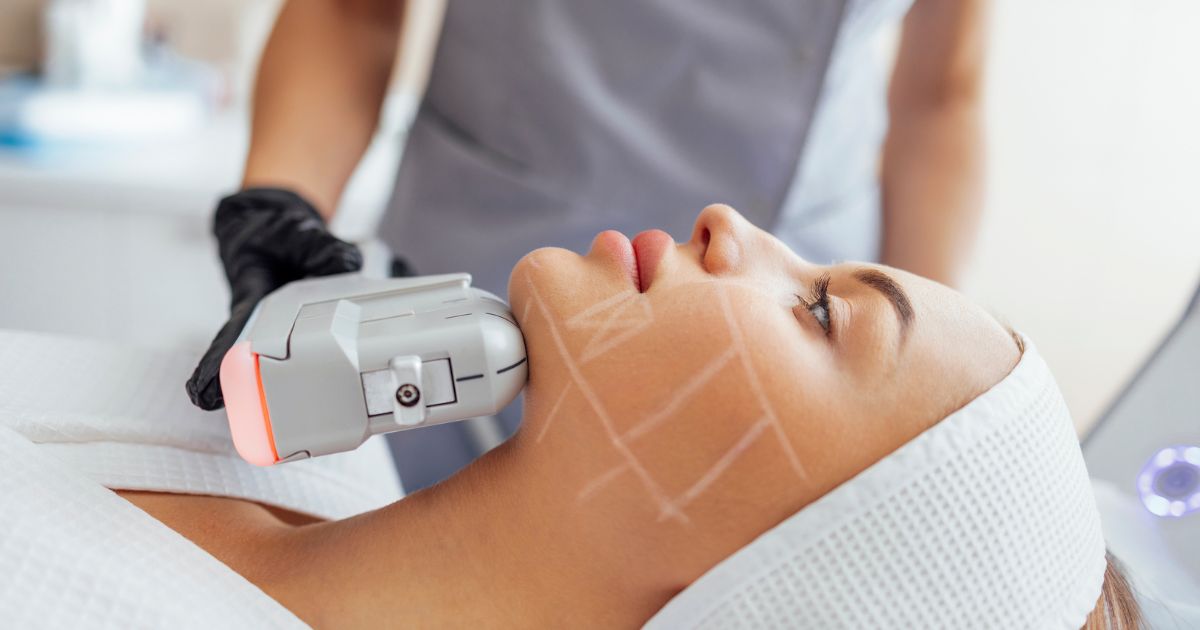 Hifuu Treatment in Greater Noida - Esthetica Esthetic Clinic_